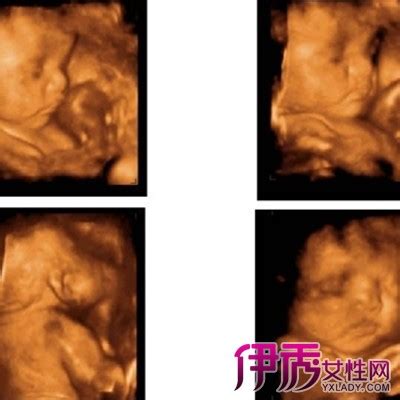【怀孕八个月的胎儿图片】【图】怀孕八个月的胎儿图片展示 初期怀孕三大症状知识普及(2)_伊秀亲子|yxlady.com
