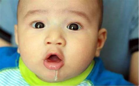 婴儿口水疹用啥最有效（令妈妈抓狂的口水疹）-幼儿百科-魔术铺