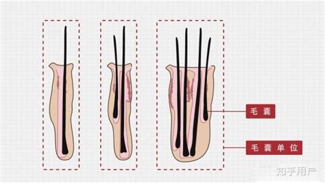 测量头发直径通常用什么单位 怎么测量头发的直径_知秀网