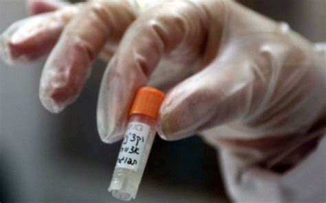 埃博拉病毒潜在药物一览_生物探索