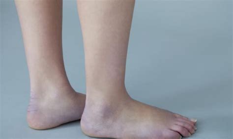 脚疼是怎么回事？不同位置疼痛的原因不同，这篇文章都说全了 - 知乎