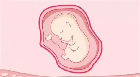 【指南解读】美国妇产科医师学会（ACOG）“胎儿生长受限指南（2019）”解读