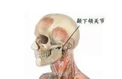 颞下颌关节解剖图图片 颞下颌关节解剖图图片