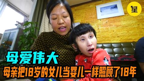 母亲把18岁的女儿当婴儿一样照顾了18年无怨无悔_腾讯视频
