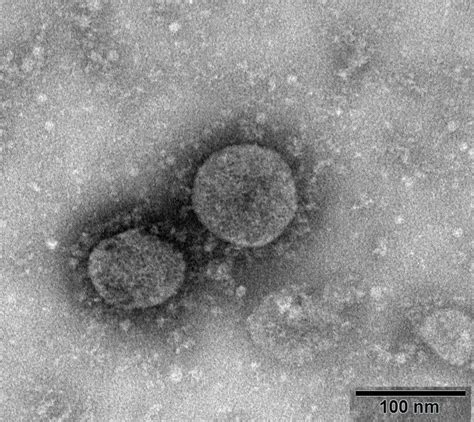 新型冠状病毒-电子显微镜下的病毒是什么样呢？