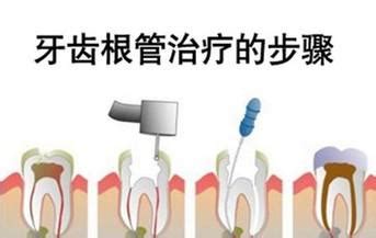 最新北京大学口腔医院价目表实拍,种牙/正畸/补牙价格都有 - 爱美容研社
