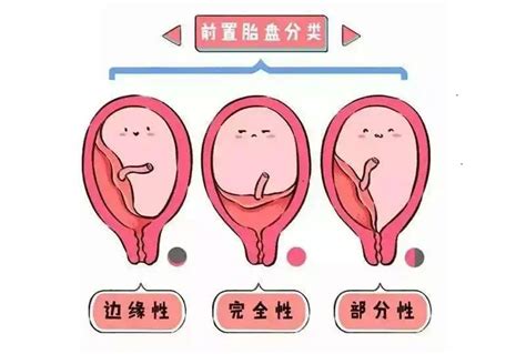 XY孕囊和XX孕囊形状大不同，长条形和圆形早已暗示胎儿性别|生男生女|糖糕妈妈育儿网