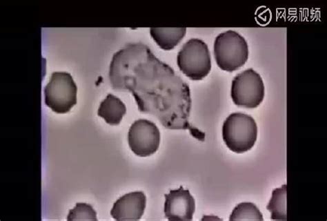 白细胞血细胞场景图片素材-正版创意图片400859865-摄图网