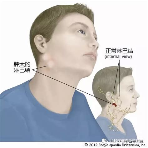 耳前淋巴结位置图图片