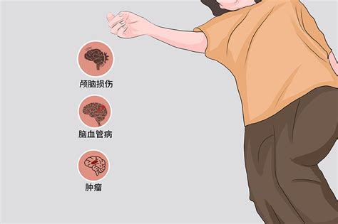 昏迷 的图像结果