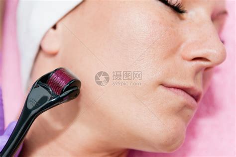 用dermaroller对女进行美容治疗高清图片下载-正版图片504935469-摄图网