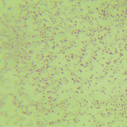 流感嗜血杆菌 BNCCBNCC259887 微生物菌种|北纳生物
