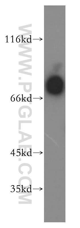 IL3RA Antibody 13655-1-AP | Proteintech