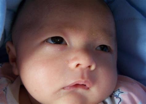 婴儿脸上小白点像粉刺（新生儿鼻子上的小白点是什么）-幼儿百科-魔术铺