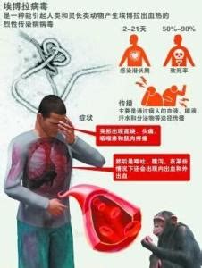 12张图解析埃博拉病毒_新闻百科_腾讯新闻_腾讯网