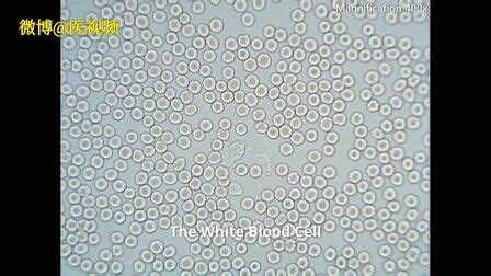 天然制剂中白色念珠菌的显微镜观察高清图片下载-正版图片505857341-摄图网