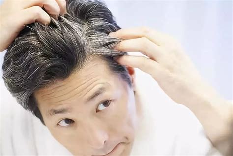 种植头发能管多长时间-发友百科