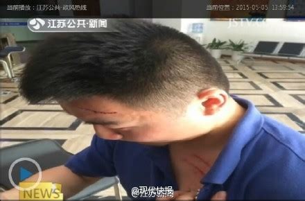 记者正常报道火灾遭殴打 全身多处严重划伤(图)_新闻频道_中国青年网