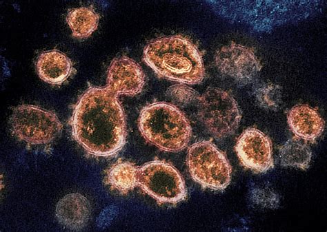 新冠病毒出新变种XE，传播速度比奥密克戎BA.2快，一份最新报告曝光_腾讯视频