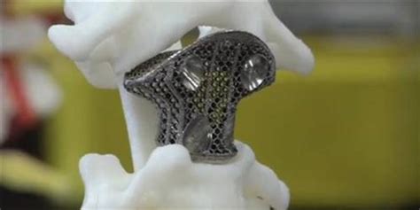 上海时光何晋龙Peek-3D人工骨填充额头安全吗？真人日记曝光 - 爱美容研社