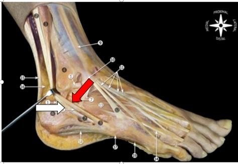 踝关节扭伤系列之八——崴脚外侧疼痛之腓骨肌腱损伤-健康160