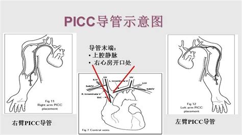 上海方塔中医医院PICC护理门诊开诊时间 - 上海慢慢看