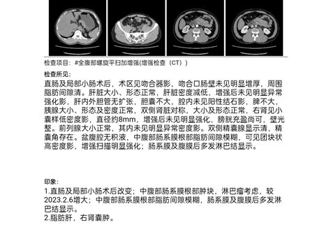 浙江湖州增强CT怀疑淋巴瘤，今天浙一PET CT确诊，等明天报告-淋巴瘤之家