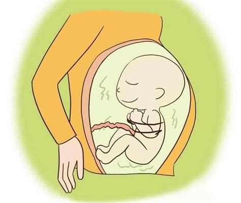 孕囊大小与孕周对照表-菠萝孕育