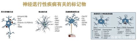 泛酸激酶相关神经变性（PKAN） - 脑医汇 - 神外资讯 - 神介资讯