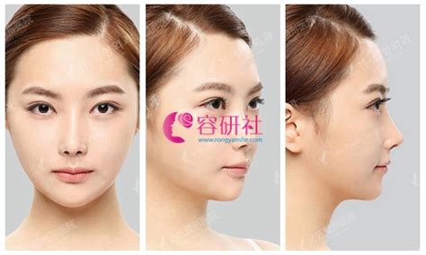 韩国必妩医疗美容是正规医院,隆胸和面部轮廓改脸型是强项 - 爱美容研社