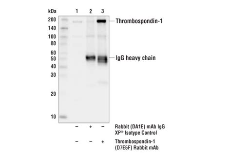 Thrombospondin-1 (D7E5F) Rabbit mAb | Cell Signaling Technology
