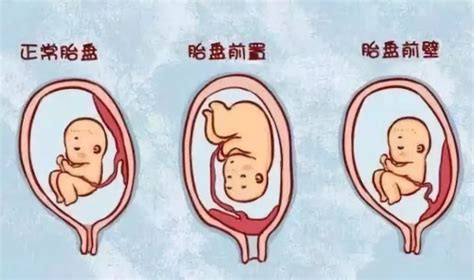 怀孕早期通过孕囊形状就能看男女，准不准看完你就知道了_家庭医生在线
