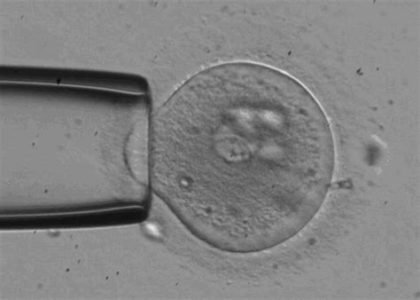 在人胚胎发育阶段素材图片免费下载-千库网