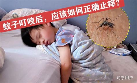 虫咬皮炎是夏秋季节常见的儿童皮肤图片_有来医生