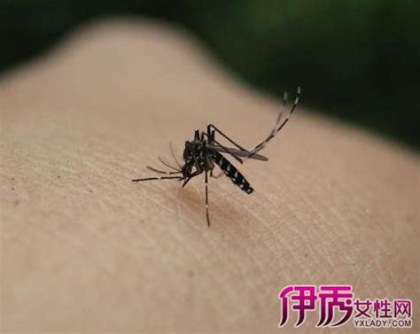 【宝宝被蚊子咬了起水泡】【图】宝宝被蚊子咬了起水泡该怎么办 多种方法让你远离蚊子(2)_伊秀亲子|yxlady.com