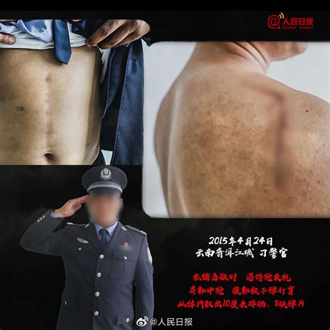 致敬！这些伤疤是禁毒民警的“勋章” - 世相 - 新湖南