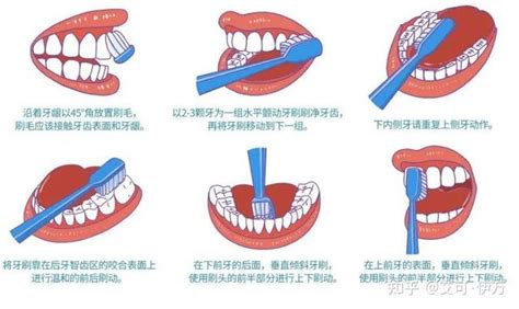 世界标准刷牙姿势-巴氏刷牙法 - 知乎