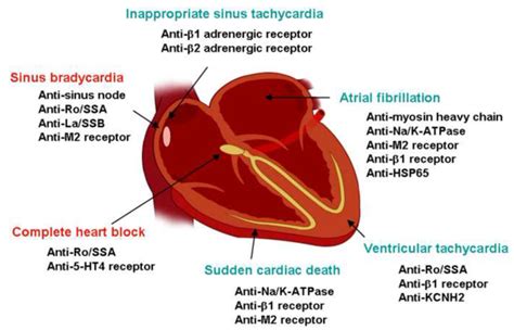 心脏起搏器是什么原理？ - 知乎