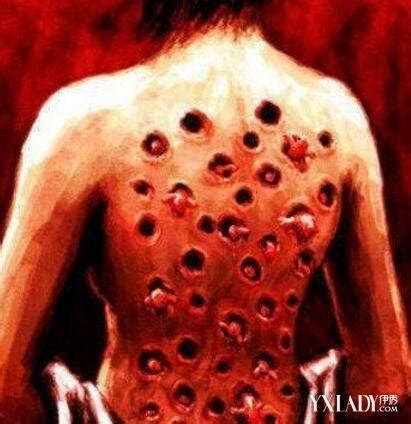 十大最恶心寄生虫中国十大寄生虫图片2022已更新今日资讯