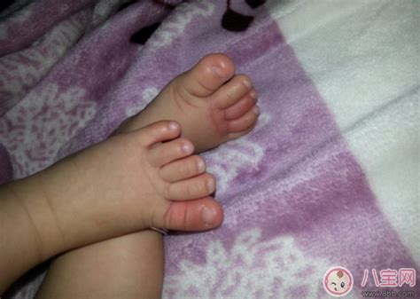 小孩子脚疼怎么办 宝宝说脚疼是哪些原因造成的 _八宝网