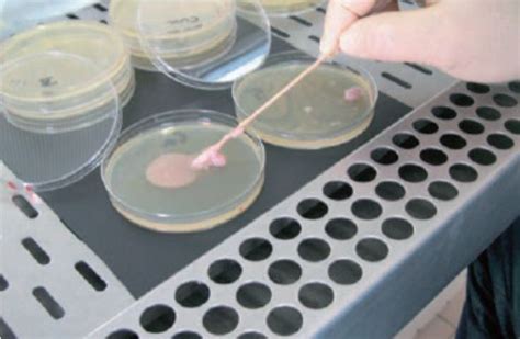 兰州泄露的布鲁氏菌，你了解多少？它比新冠病毒更可怕 - 知乎
