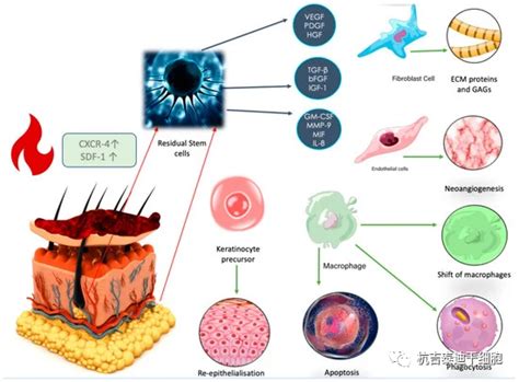 间充质干细胞疗法丨处理修复烧伤的新希望-杭吉干细胞科技