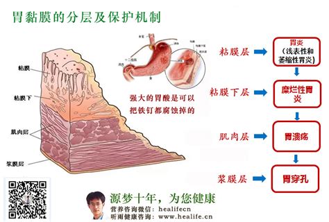胃粘膜分层,胃粘膜分层图,胃黏膜分层分层_大山谷图库