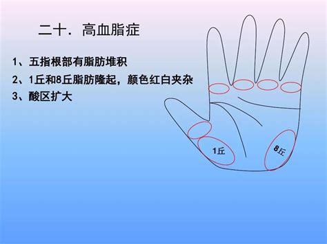 手诊图解看疾病图片