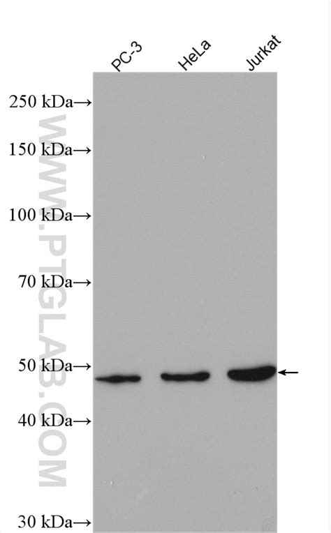 ARP3/ARP3B Antibody 13822-1-AP | Proteintech
