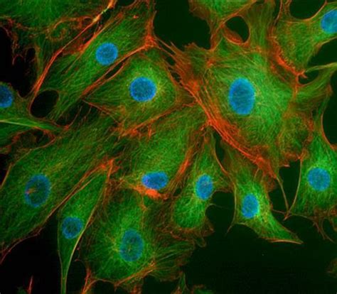 答生物教师问：细胞骨架属于细胞质基质还是细胞器？