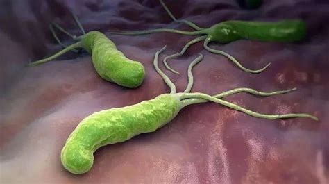 你知道幽门螺旋菌的危害吗？_传染病知识_上海凯创生物技术有限公司
