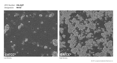 NK-92细胞ATCC CRL-2407细胞 NK92人恶性非霍奇金淋巴瘤患者的自然杀伤细株购买价格、培养基、培养条件、细胞图片、特征等基本 ...