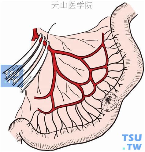 图14-14 结肠动脉的变异-腹部外科临床解剖学-医学