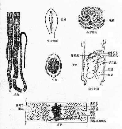 裂头蚴寄生虫图片